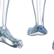 「足の慢性的な傷」の検査―どんな種類があるの？
