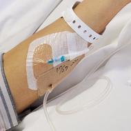多発性骨髄腫の治療、若い方への治療「造血幹細胞移植」について。