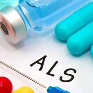 ALS(筋萎縮性側索硬化症)の原因