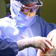 画像でみる膝周囲骨切り術（AKO）による手術の流れ