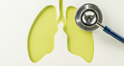 原因や種類の異なる肺がんの基礎、診断および治療選択の方法