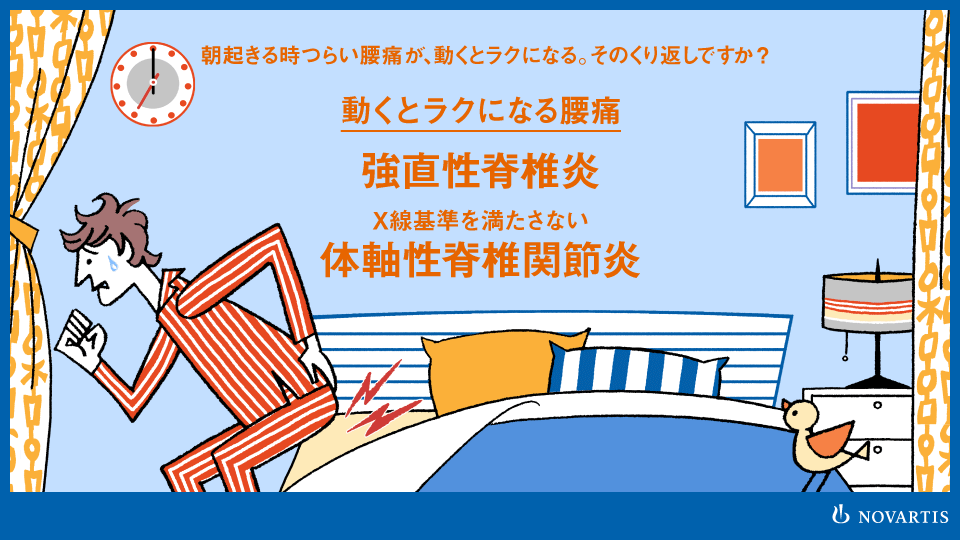強直性脊椎炎の症状との付き合い方 | メディカルノート
