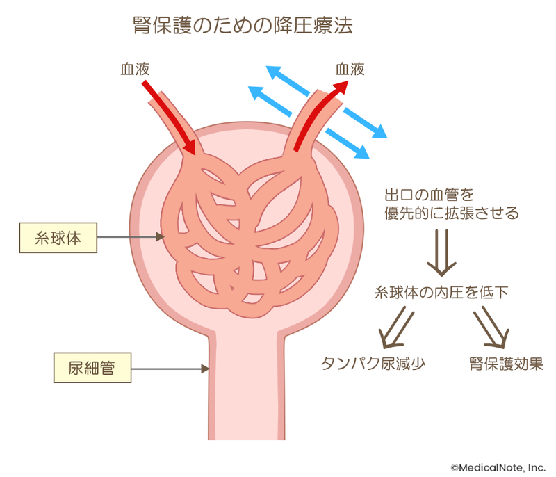 MN作成