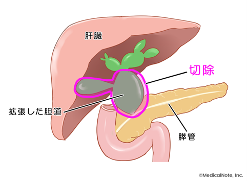 MN作成