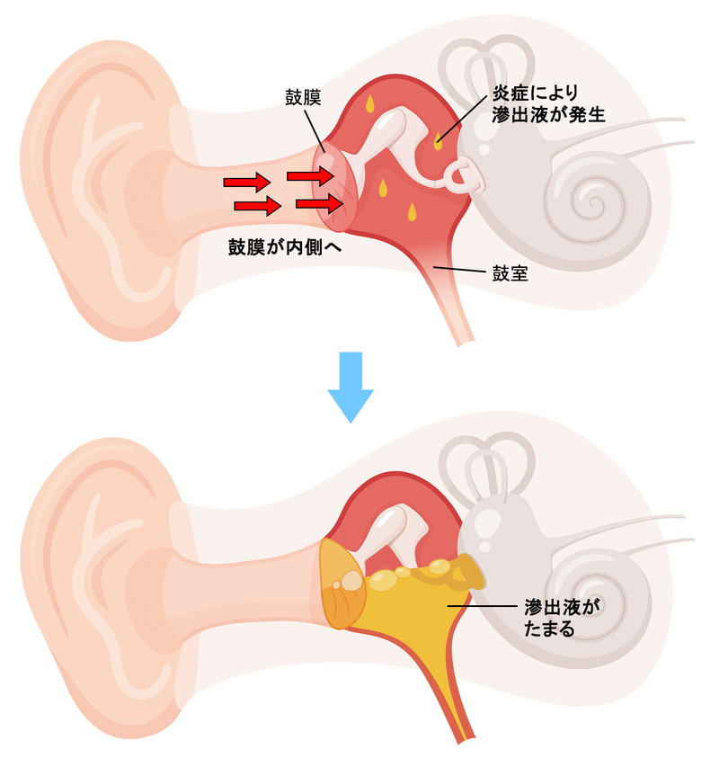 画像：PIXTA　加工：MN