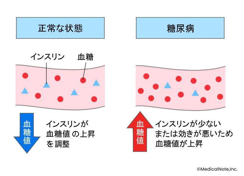 血管の様子（MN作成）