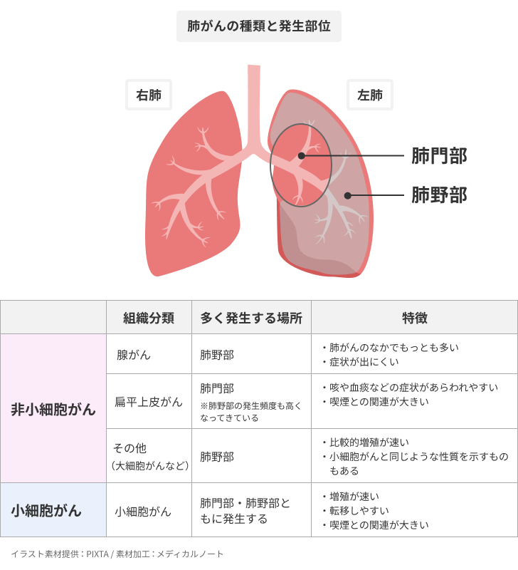 素材PIXTA／加工MN