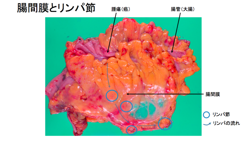 腸間膜とリンパ節