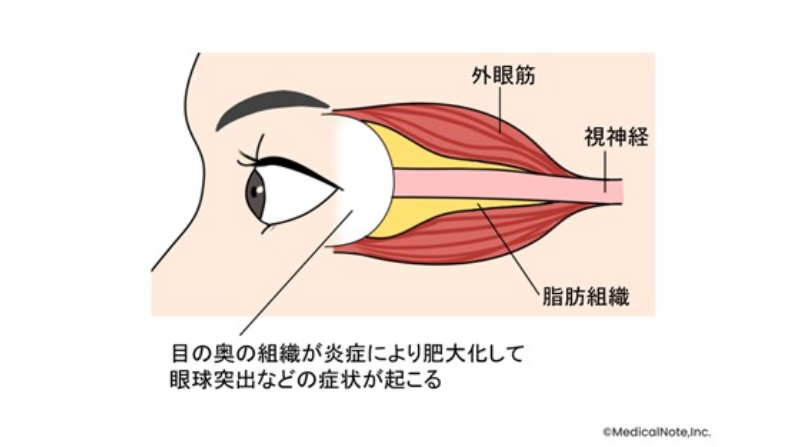 メディカルノート