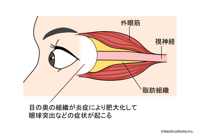 メディカルノート