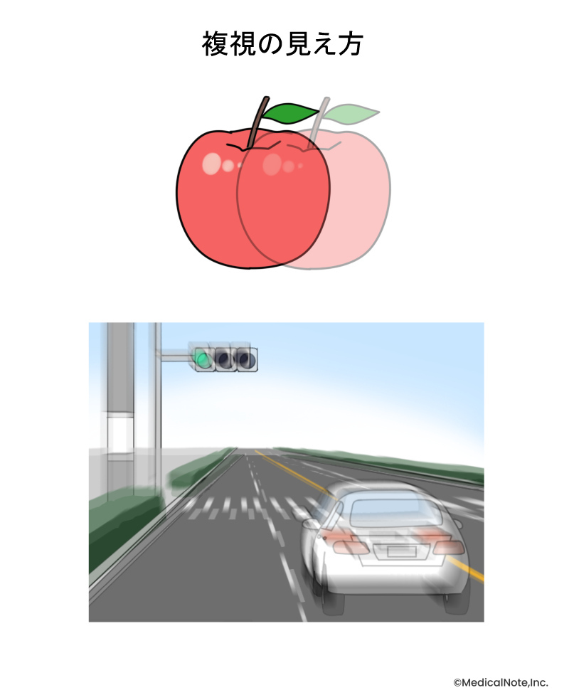 メディカルノート