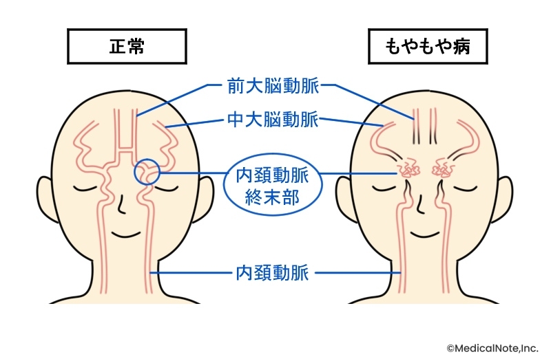 メディカルノート