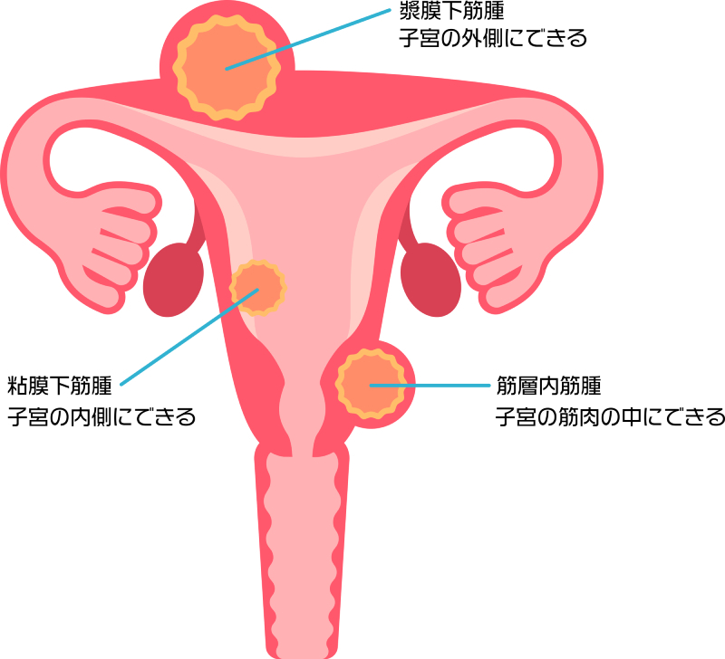 イラスト：PIXTA