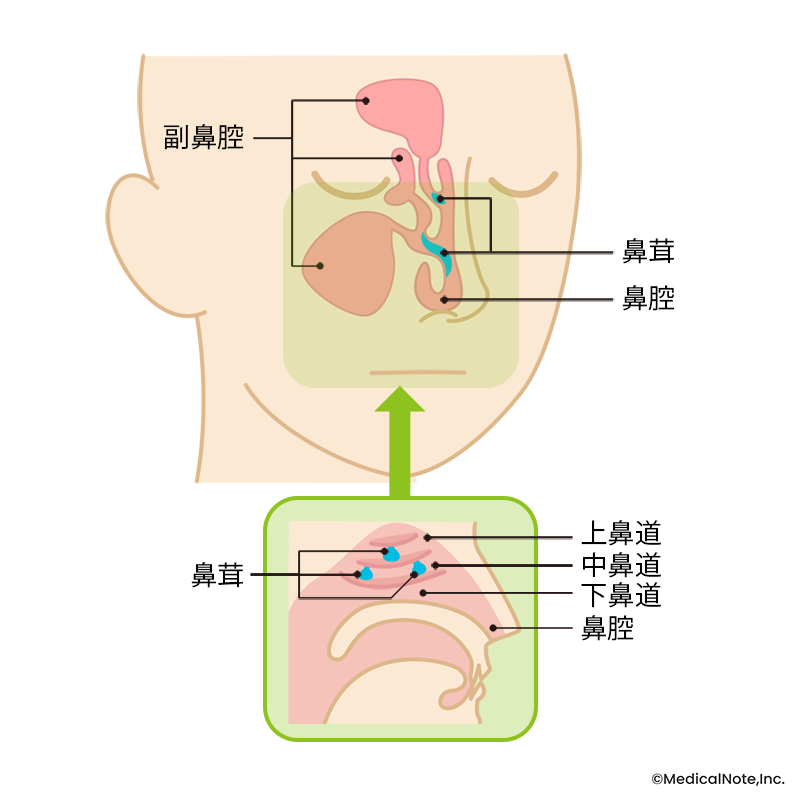 鼻茸