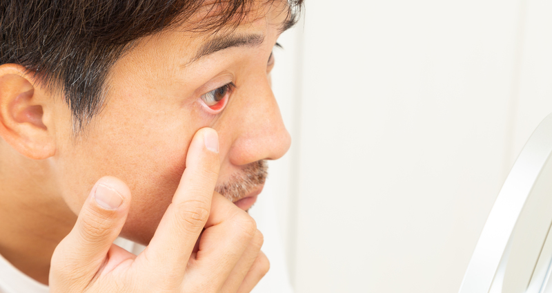 目の周りの乾燥を防ぐ