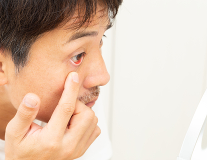 スタージ・ウェーバー症候群はどのように治療されますか?