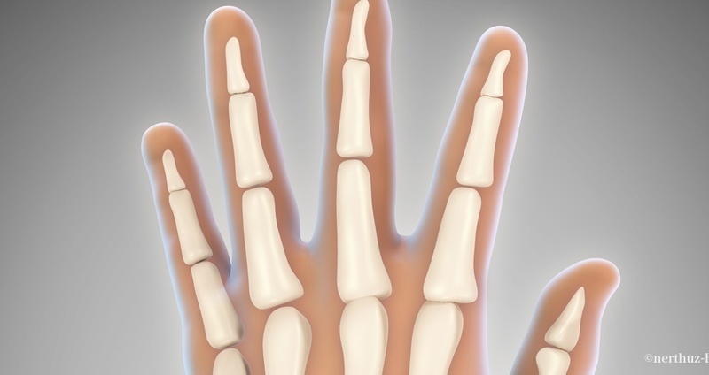 指の変形関節症