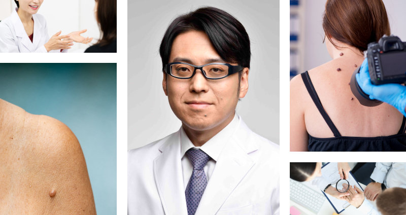 医師は表在性黒色腫をどのように診断するのでしょうか?