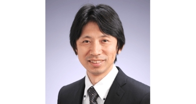 関節リウマチは早期に適切な治療を始めることが重要――関節超音波検査で早期診断へ