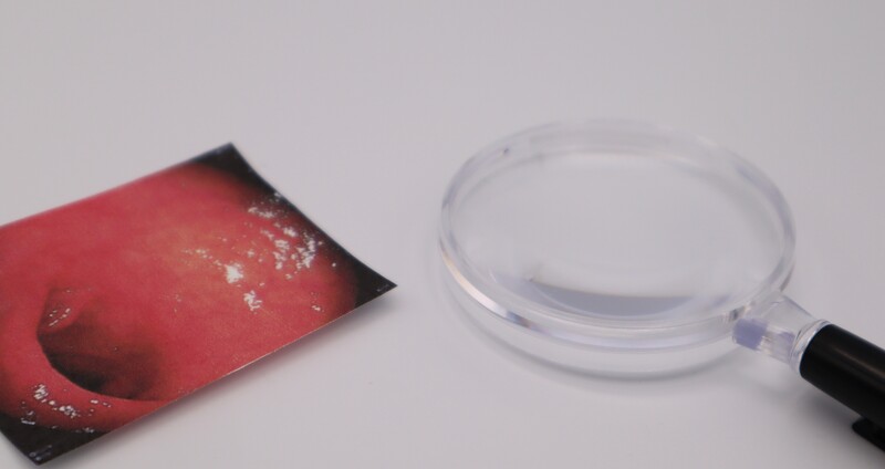 胃がん検診：2年に1回受ける理由