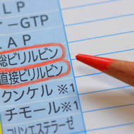 黄疸とは？大人の症状・原因から治療まで