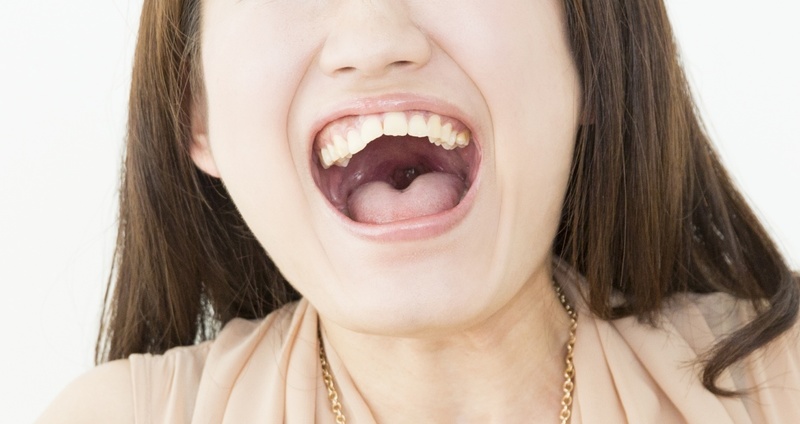 舌咽神経痛とは——三叉神経痛と同様に、強い痛みを喉や耳に生じる病気