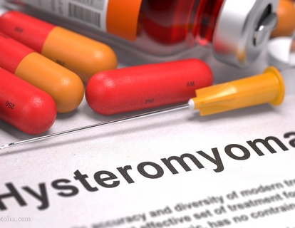 婦人科手術における低侵襲手術とは？ | メディカルノート