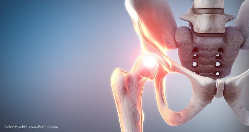 Fasciaリリースの応用―坐骨神経痛様の下肢痛の治療