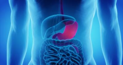 胃潰瘍（胃かいよう）とはどのような病気？胃カメラの写真でみるステージごとの症状