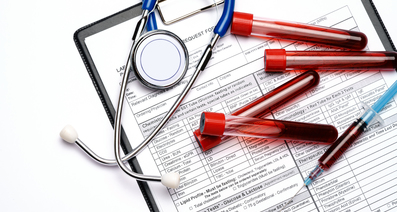 自己免疫性肝炎の検査と診断——検査が必要な場合とは？