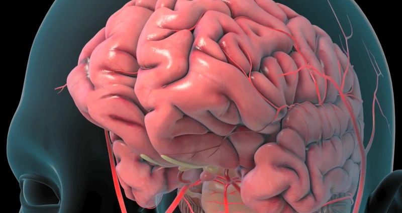 脳動静脈奇形（AVM）とはー専門医に聞く、液体塞栓物質（Onyx，NBCA