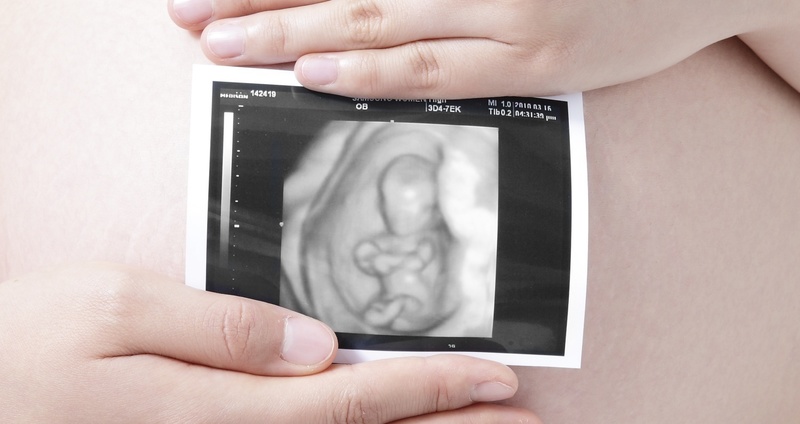 赤ちゃんを出産するときの注意－計画早産が好ましくない理由