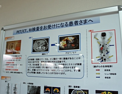 放射線診断学レクチャーノート P.R.パテル 放射線診断学とは。見えないものを見る「目」と「知識」 | メディカル