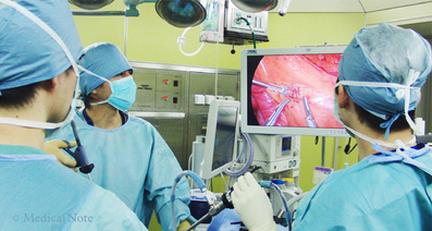 写真・画像でみる大腸がんの腹腔鏡下手術