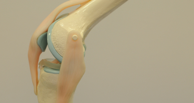 変形性膝関節症におけるMIS（Minimum Invasive Surgery）人工膝関節置換術とは？ MIS人工膝関節置換術の特徴や経過について解説