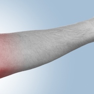 【特集】関節リウマチの症状とは。朝、関節のこわばりを感じたら要注意